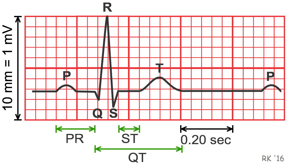 cv-physiology-electrocardiogram-ekg-ecg